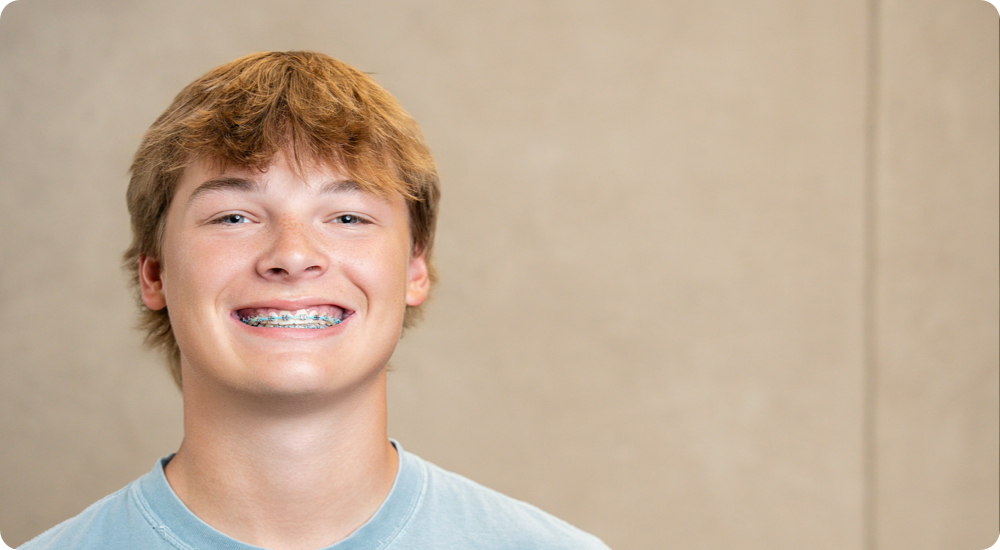 Teen with braces during orthodontic treatment at Feagin Family Orthodontics