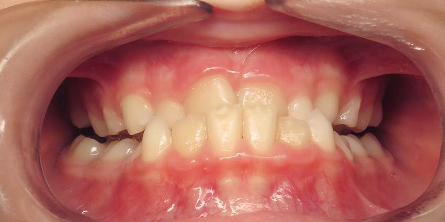 Before treatment