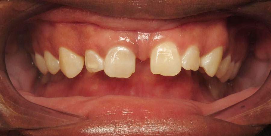Before treatment